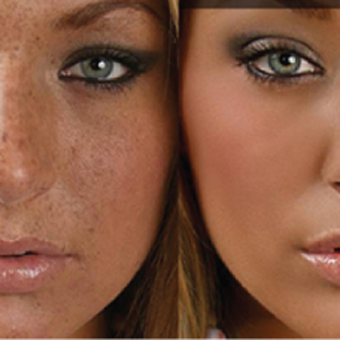 pigment removal skin rejuvination